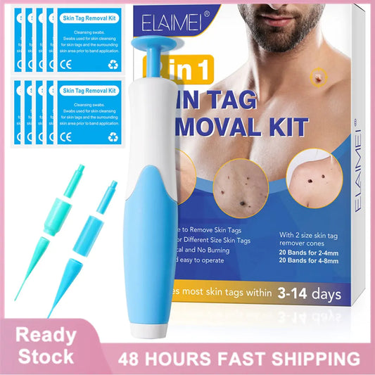Skin Tag Remover Kit